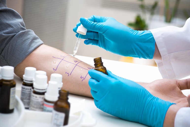allergy_test.jpg