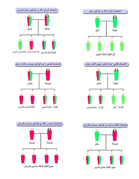 التلاسيميا