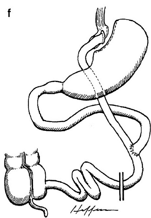 1 - f.jpg