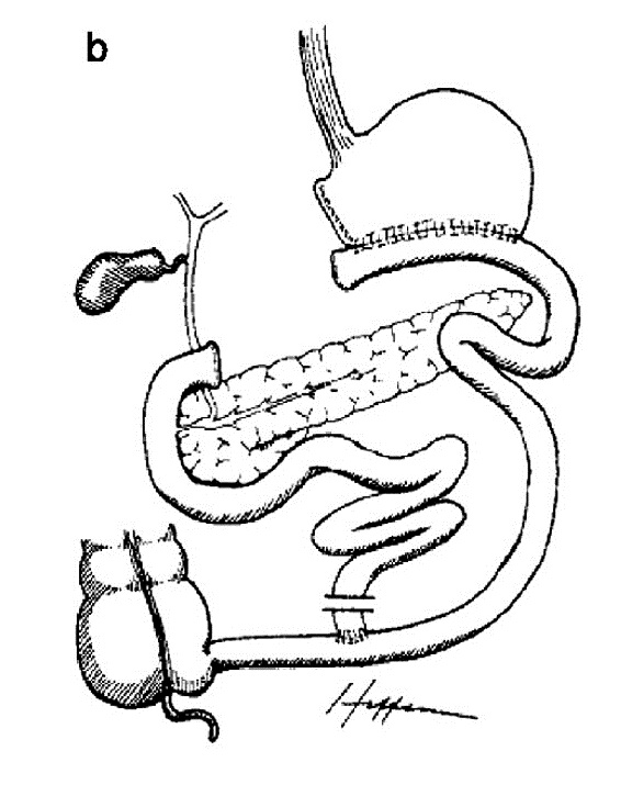2 +3  - b.jpg