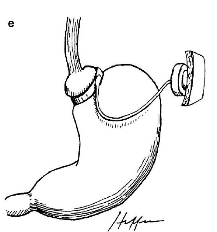 3 -e.jpg