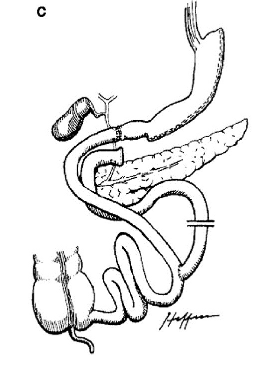 3- c.jpg