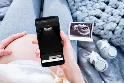 אישה בהיריון צופה בבדיקת אולטרסאונד במסך סמארטפון