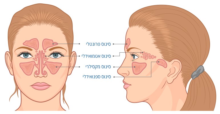 איור של מיקום הסינוסים בעצמות הפנים - סינוס פרונטלי, סינוס אטמואידלי, סינוס מקסילרי, סינוס ספנואידלי