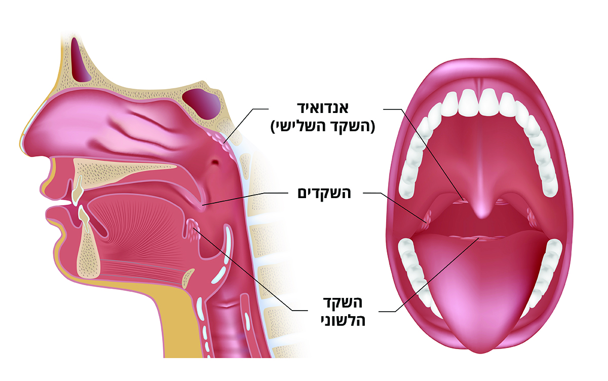 איור שמציג את מיקום השקדים בלוע
