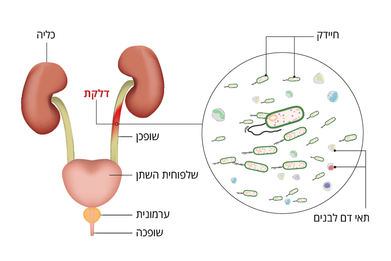 מערכת השתן